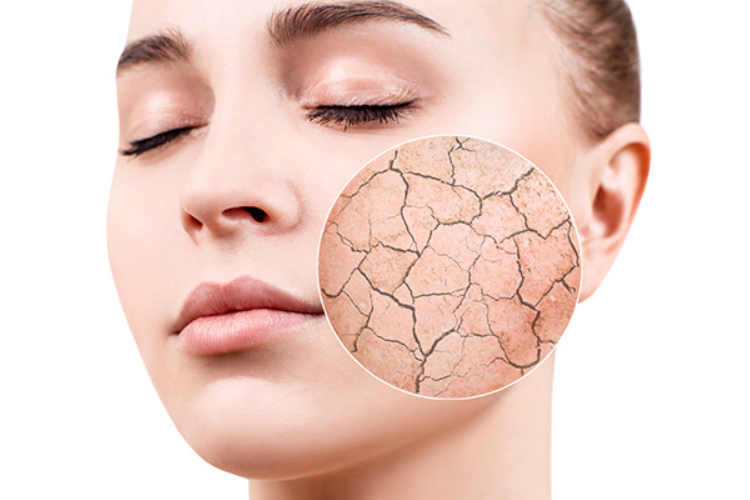 3 Consecuencias de No Cuidar tu Piel