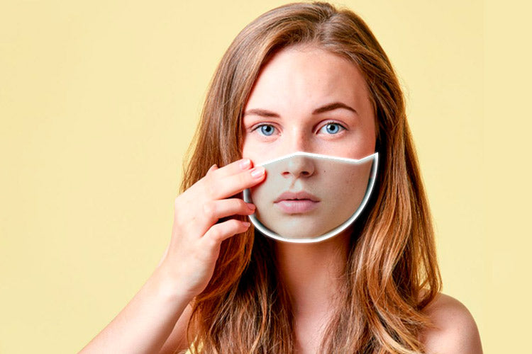 Maskne el Nuevo Acné: ¿Cómo evitarlo?